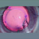 Cornea-3D escasez